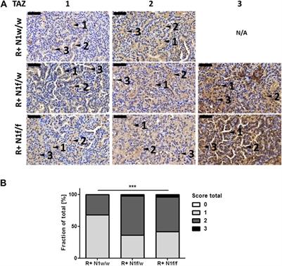 Notch1 Deficiency Induces Tumor Cell Accumulation Inside the Bronchiolar Lumen and Increases TAZ Expression in an Autochthonous KrasLSL-G12V Driven Lung Cancer Mouse Model